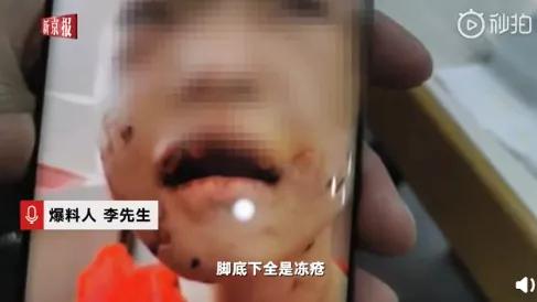 将4岁女童打到多器官衰竭，这样的继母也配当人？